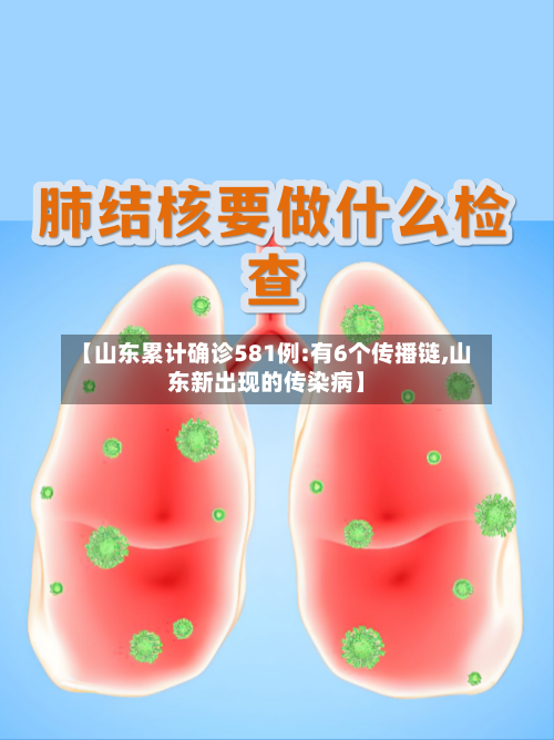 【山东累计确诊581例:有6个传播链,山东新出现的传染病】-第3张图片