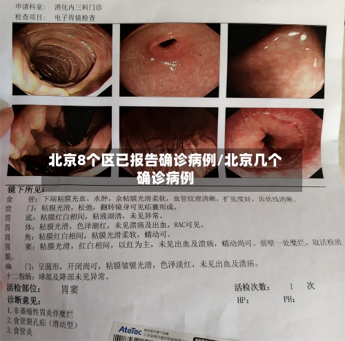北京8个区已报告确诊病例/北京几个确诊病例-第2张图片