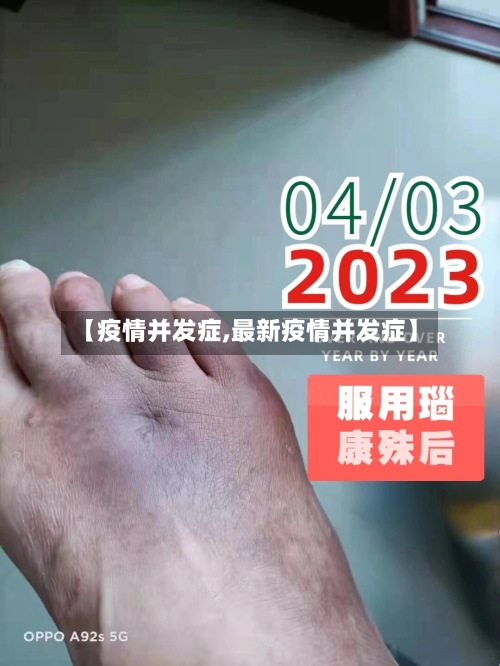 【疫情并发症,最新疫情并发症】