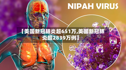 【美国新冠肺炎超651万,美国新冠肺炎超2839万例】