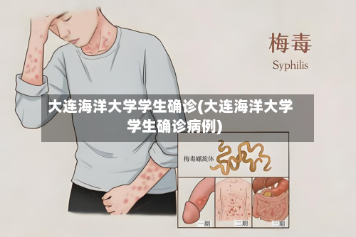 大连海洋大学学生确诊(大连海洋大学学生确诊病例)