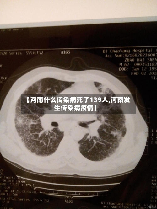 【河南什么传染病死了139人,河南发生传染病疫情】