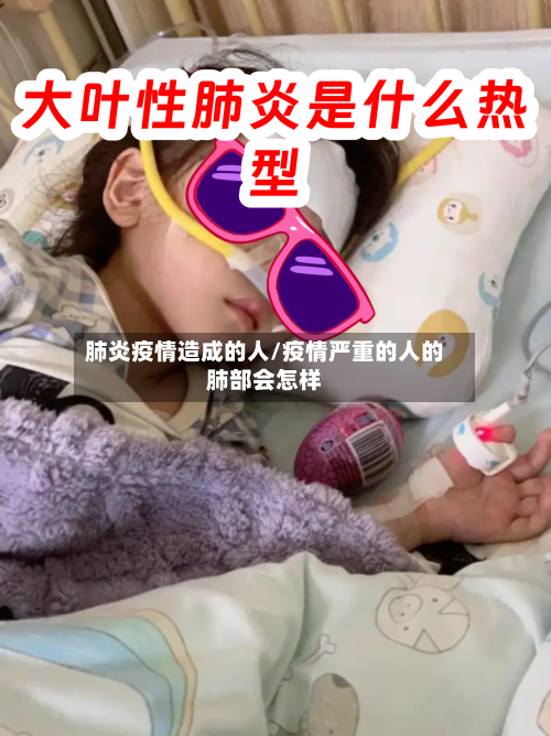肺炎疫情造成的人/疫情严重的人的肺部会怎样-第2张图片