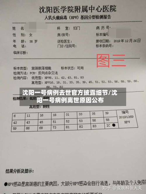 沈阳一号病例去世官方披露细节/沈阳一号病例离世原因公布