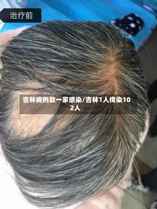 吉林病例致一家感染/吉林1人传染102人