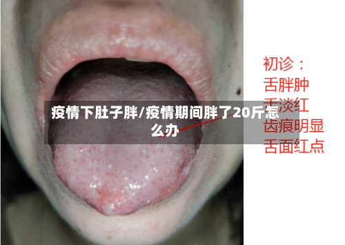 疫情下肚子胖/疫情期间胖了20斤怎么办-第3张图片