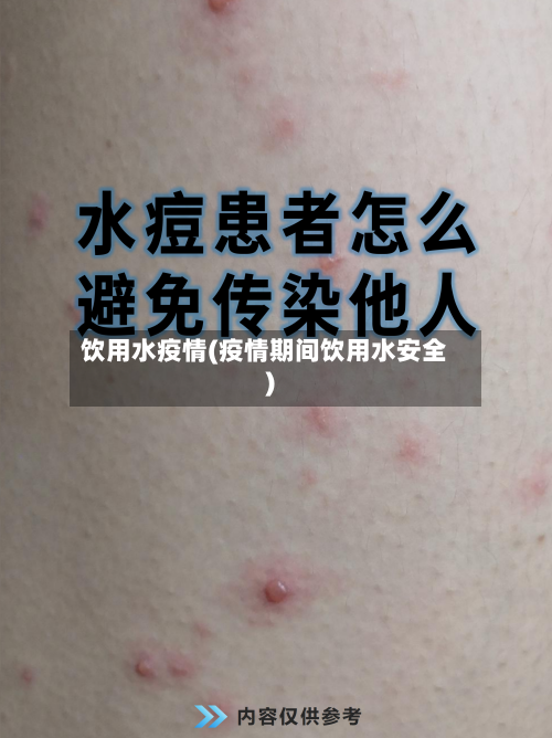 饮用水疫情(疫情期间饮用水安全)-第3张图片