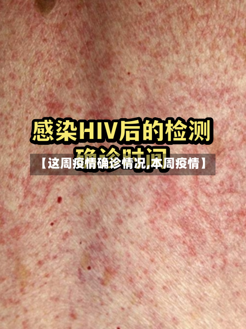 【这周疫情确诊情况,本周疫情】