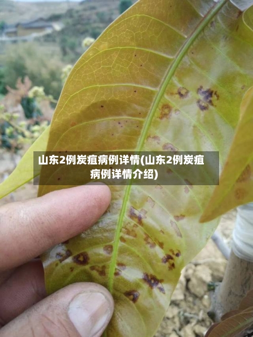 山东2例炭疽病例详情(山东2例炭疽病例详情介绍)