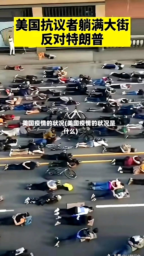 美国疫情的状况(美国疫情的状况是什么)-第3张图片