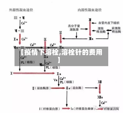 【疫情下溶栓,溶栓针的费用】-第3张图片