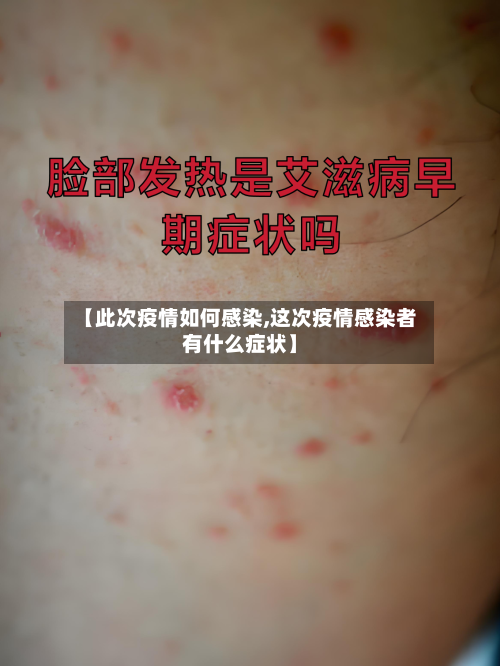 【此次疫情如何感染,这次疫情感染者有什么症状】-第2张图片