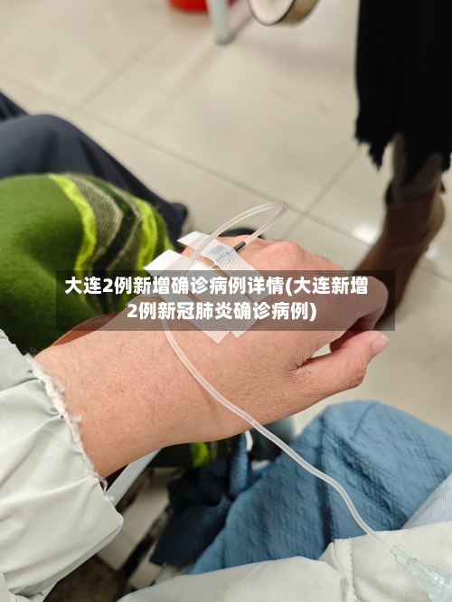 大连2例新增确诊病例详情(大连新增2例新冠肺炎确诊病例)
